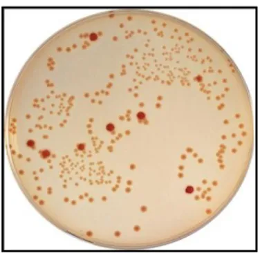 Gambar 3.E. coli yang dikultur pada media selektif Mc Conkey Agar 