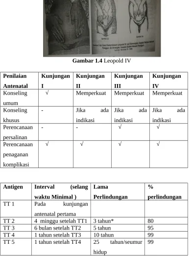 Gambar 1.4 Leopold IV