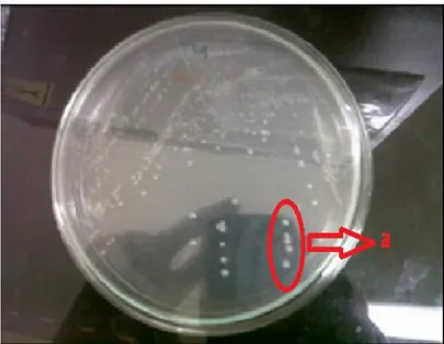 Gambar 2  Hasil positif kultur Brucella pada media TSA. 