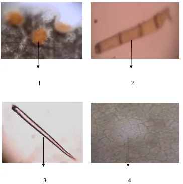 Gambar 5. Mikroskopik Serbuk Simplisia Daun Zodia 