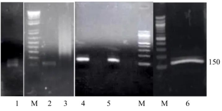 Gambar 1. Hasil  PCR  pada  suhu  penempelan (SA) 46°C  dan reamplifikasi pada  suhu 53°C