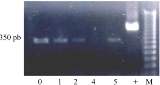 Gambar 5.  Hasil RT-PCR  pada suhu  penempelan 60°C  menunjukkan  pola pita  diferensial (lajur 0                      hingga 5)