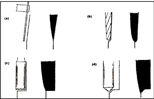 Gambar 4. Desain cavosurface margin:  (a). Knife-edge, (b). Chamfer, (c). Shoulder, (d)