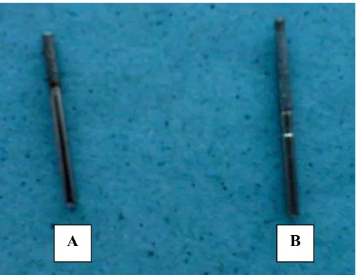 Gambar 9. Alat-alat preparasi overlay : A. Bur intan silindris; B. Bur intan torpedo 