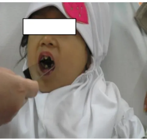 Gambar 2. Ekspresi wajah pasien 