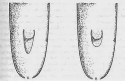 Gambar 3. Alat kelamin ikan baung jantan (A) dan Betina (B)