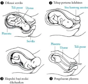 Gambar 7. Tahapan kelahiran bayi