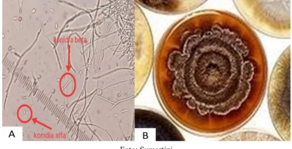 Gambar 4. Spora cendawan Phomopsis sp. Konidia alfa dan konidia beta (A), Koloni cendawan  Phomopsis pada media AKD (B)