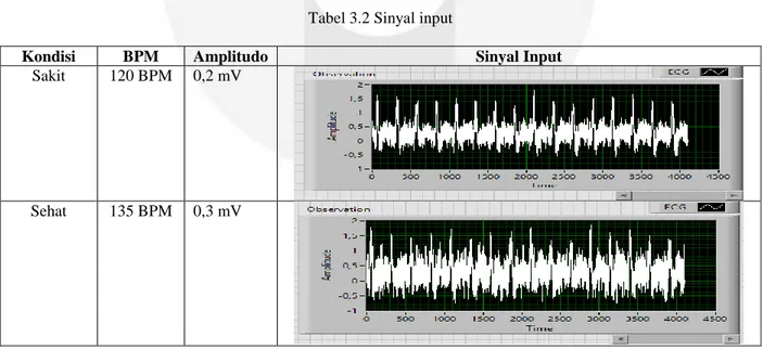 Tabel 3.1 Parameter EKG 