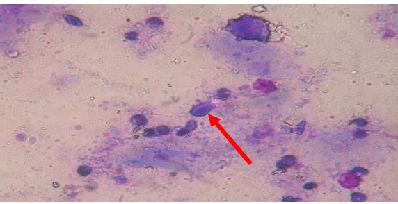 Gambar 4. Bentuk sel T. vaginalis setelah perlakuan dengan pengujian ekstrak 