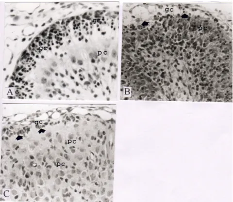 Gambar 1. Kerusakan cerebelum di daerah EGL berupa kematian sel granulosa akibat iradiasi sinar-X, diamati dengan pewarnaan hematoksilin eosin