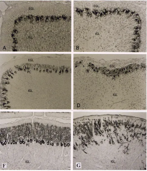Gambar 2 menunjukkan perkembangan sel Purkinje setelah iradiasi sinar-X. 24 jam setelah iradiasi sinar X (anak tikus umur 5 hari/P5), susunan sel Purkinje tidak