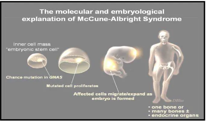 Gambar 1. Patofisiologi Sindrom McCune-Albright secara molekular.4,8 
