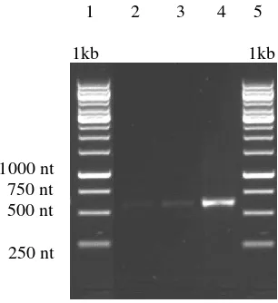 Gambar 4. Visualisasi hasil pre-test  kualitas produk PCR pada gel agarosa 1%. Keterangan: kolom 1=marker, 2= Bj 6, 3= Bj 11, 4= P 22 dan kolom 5= marker 