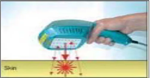 Gambar 4. Polylaser trion, laser multi cluster untuk area terapi yang luas16