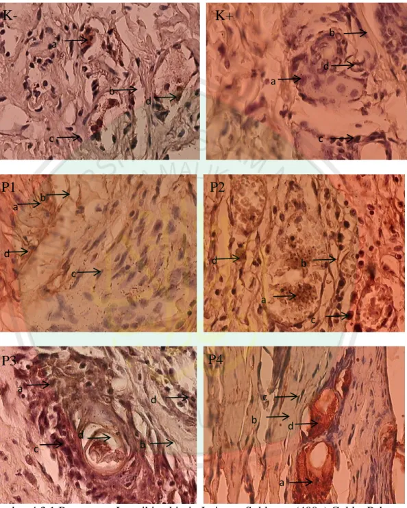 Gambar 4.3.1 Pewarnaan Imunihistokimia Jaringan Subkutan (400x) Coklat Pekat  pada sitoplasma