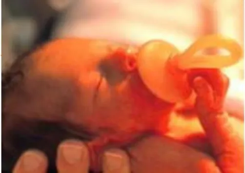 Gambar 2.1. Bayi Prematur  2.2.6  Baby Incubator 