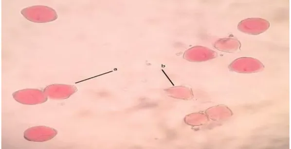 Gambar 5.5. Foto Serbuk Sari Bunga Cabai Merah; a) Serbuk Sari Viabel,  b) Serbuk Sari Tidak Viabel; Perbesaran Mikroskop 4 x 10 