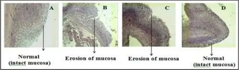 Figure 6. Histopathology of rats gastric mucosa inpylorus ligation-induced ulcer method (Hematoxyllinand  Eosin)