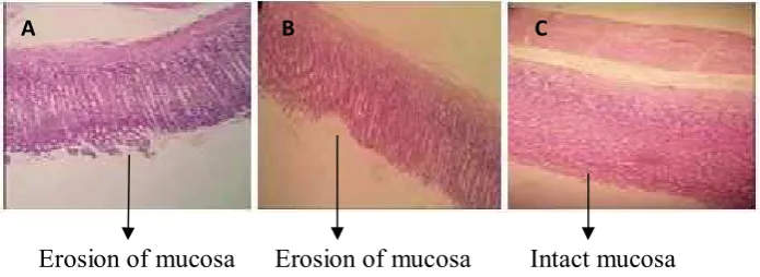 Figure 6. Histological section of rats gastric mucosa (10x10) after 7 days treatment.  A: Withouttreatment ; B: Given sucralfate suspension, and C: Given alginate liquid