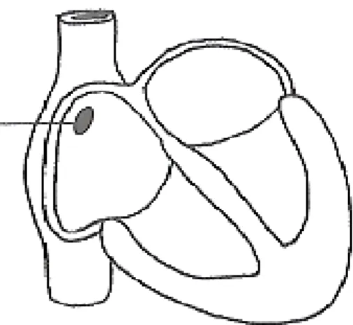 Diagram 8 shows a longitudinal section of human heart. Structure R is a pacemaker.  