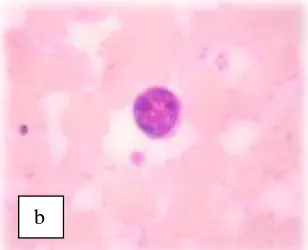 Gambar 4.2 (a) Eosinofil (b) Limfosit (c) Monosit (d) Neutrofil 