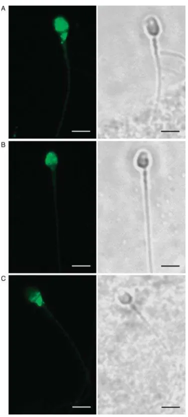 Figure 3 Ultrastructural analysis of MSMB localization in humanspermatozoa by immunoelectron microscopy