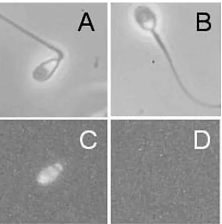 Figure 1. TUNEL-positive spermatozoa indicating presenceof DNA damage. (A) and (B) phase contrast images; (C)TUNEL-positive cell; (D) TUNEL-negative cell.