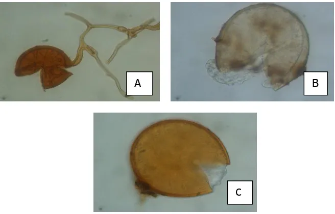 Gambar 3. Genus FMA yang ditemukan pada rhizosfer tanaman umbi yang tumbuh di bawah tegakan 