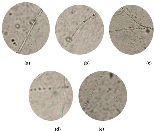 Gambar 2. Hifa Phaeophleospora sp. pada perlakuan 0 mg/ml (a), 0.28 mg/ml (b), 0.56  mg/ml (c), 0.84 mg/ml (d), 1.12 mg/ml (e)