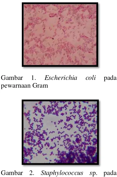 Gambar 2. Staphylococcus sp. pada pewarnaan Gram 
