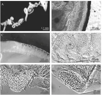Fig. 3. Paguristes eremita: stereomicroscopy and interference phase-contrast microscopy of male reproductive apparatus and stagesof spermatophore maturation