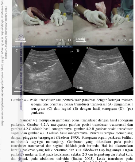 Gambar 4.2 Posisi transduser saat pemeriksaan pankreas dengan kelenjar mamari 