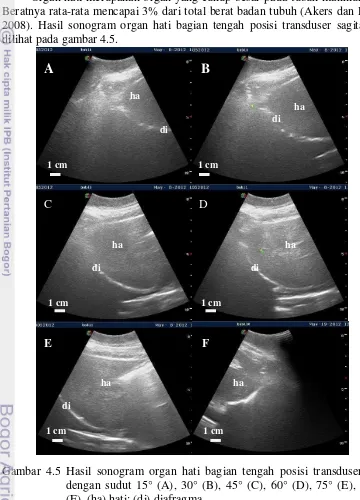 Gambar 4.5 Hasil sonogram organ hati bagian tengah posisi transduser sagital 