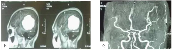 Gambar 17. Durante operasi