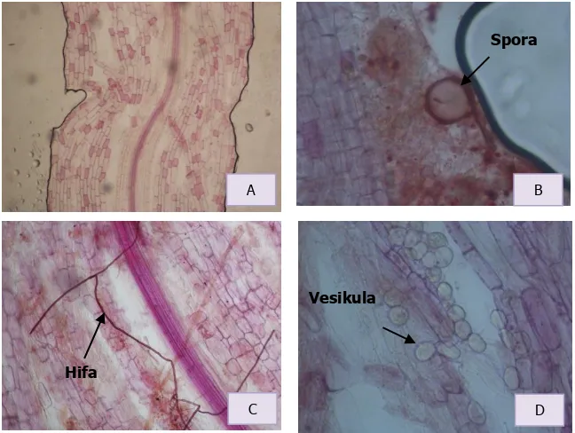 Gambar 1. Kolonisasi infeksi FMA pada akar tanaman jati, (A) akar yang tidak bermikoriza, perbesaran 20x; (B) akar yang terinfeksi spora, perbesaran 40x; (C) akar yang terinfeksi hifa, perbesaran 20x; (D) akar yang terinfeksi vesikula, perbesaran 40x