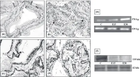 Fig. 3 Androgen receptor (AR) immunolocalisation in representative prostate sections of rat; (a) negative control, (b) age matched vehicle treatedcontrol showing positive staining in the epithelial and stromal cell nuclei () compared with decrease in staining intensity after (c) 15 days and(d) 30 days of chronic EB treatment, (e) semiquantitative RT-PCR showing AR mRNA expression in control versus 15 and 30 days of EB exposure(upper lane: AR, lower lane: internal control, b-actin), (f) Western blot showing AR protein expression in control versus 15 and 30 days of EBexposure (upper lane: AR, lower lane: b-actin); 400· (the ﬁgure is representative of three identical experiments).