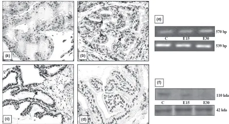 Fig. 4 Androgen receptor (AR) immunolocalisation in representative seminal vesicle sections of rat; (a) negative control, (b) age matched vehicletreated control showing positive staining in the epithelial and stromal cell nuclei () compared with decrease in staining intensity after (c)15 days and (d) 30 days of chronic EB treatment, (e) semiquantitative RT-PCR showing AR mRNA expression in control versus 15 and 30 days ofEB exposure (upper lane: AR, lower lane: internal control, b-actin), (f) Western blot showing AR protein expression in control versus 15 and30 days of EB exposure (upper lane: AR, lower lane: b-actin); 400· (the ﬁgure is representative of three identical experiments).