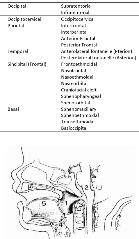 Tabel 1. Encephalocele berdasarkan lokasi anatomis. 