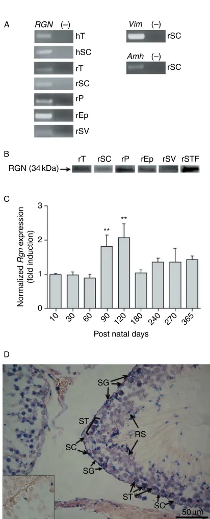 Fig. 2In rat testis RGN protein was localized to LC and SCand D). Although cell localization was essentiallycytoplasmic, some nuclear staining is visible particularlyin rat sections (A and C)