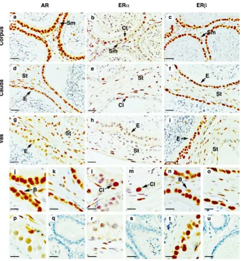 Figure 2. Immunostaining of AR, ER�r, t), and ER� in mouse corpus epididymis (a–c, j, l, n), cauda epididymis (d–f, k, m, o), and vas deferens (g–i, p,