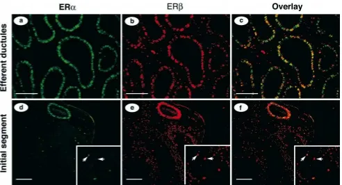 Figure 4. Western blot analysis of AR, ER�, and ER� in mouse tissues. (a) AR. Mouse testis (1), mouse epididymis (2)