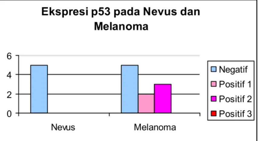 Gambar 2 Fotomikroskopi Melanoma maligna dengan pewarnaan antibodi p53 pembesaran 400 X Tampak sel tumor memberikan reaksi positif dengan inti