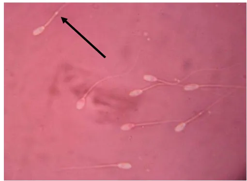 Gambar 3 Spermatozoa yang memiliki  Cytoplasmic droplet (adanya lingkaran pada bagian ekor)