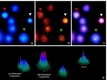 Fig. 2 Sperm DNAcombined with thesimultaneous visualization ofsperm methylation (panelusing anti-5metyl-C