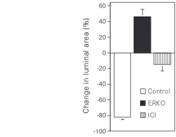 Figure 5 The effects ofductule segments 24 h after ligation. Mean ( in vitro ligation on changes in luminal area of efferent� s.e.m.) percentage differencebetween 0 h and 24 h in luminal areas for isolated ductules from wild-typecontrols, ERKO and ICI-treated mice.