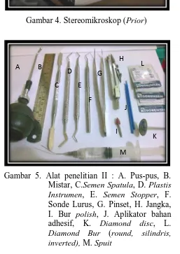 Gambar 5. Alat penelitian II : A. Pus-pus, B.  Mistar, C.Semen Spatula, D. Plastis 