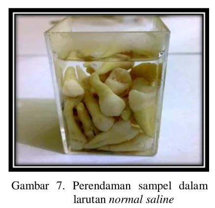 Gambar 7. Perendaman sampel dalam  larutan normal saline 
