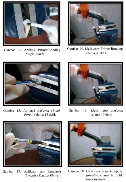 Gambar 14. Light cure Primer/Bonding selama 20 detik  