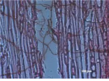 Gambar 3.2.   Hifa jamur patogen yang masuk pada  jaringan sel-sel kayu pohon penghasil  gaharu setelah  tiga bulan diinokulasiB